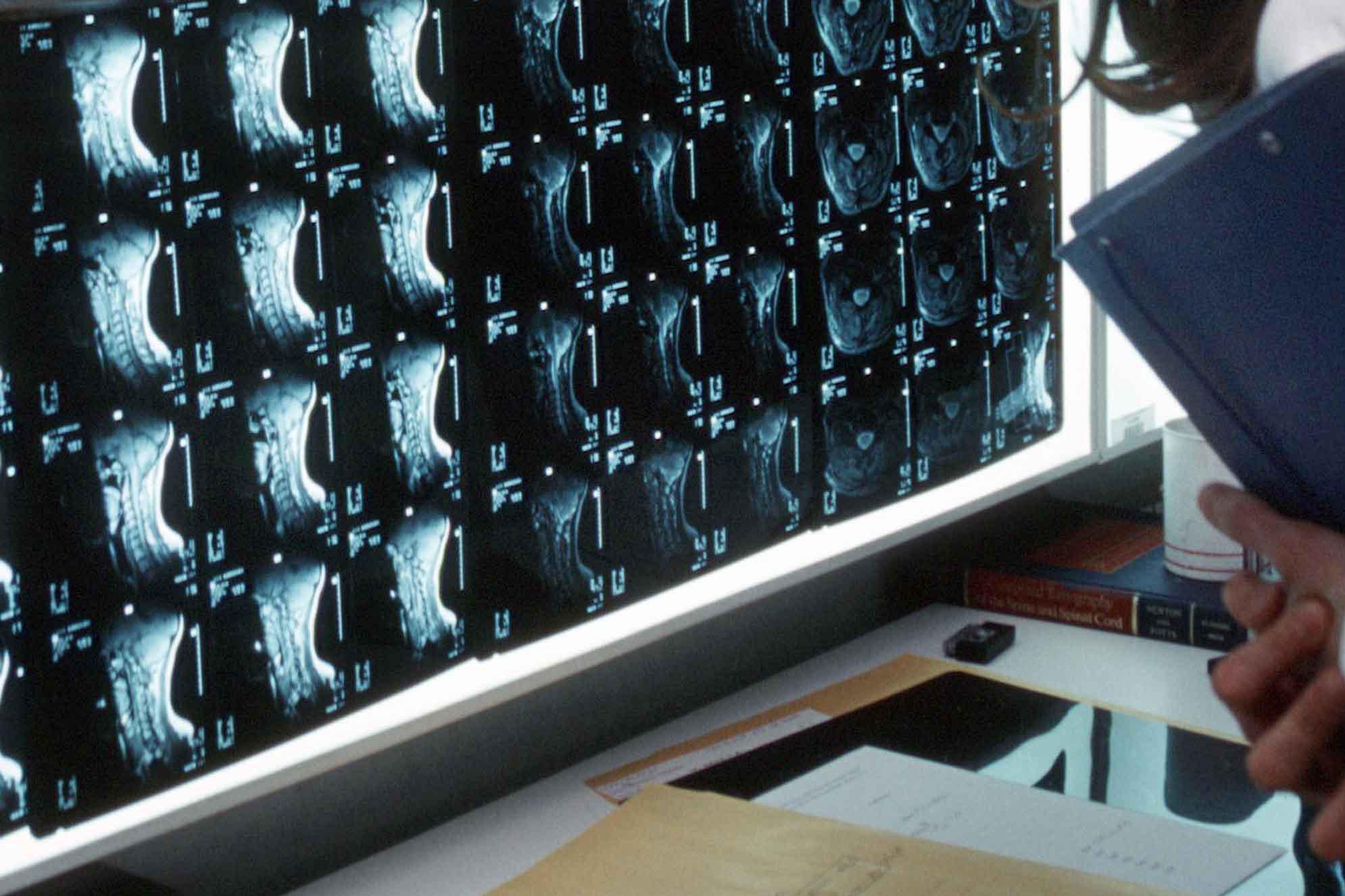 esami di radiografia da risonanza magnetica o tac local caption examens de radiographie scanner